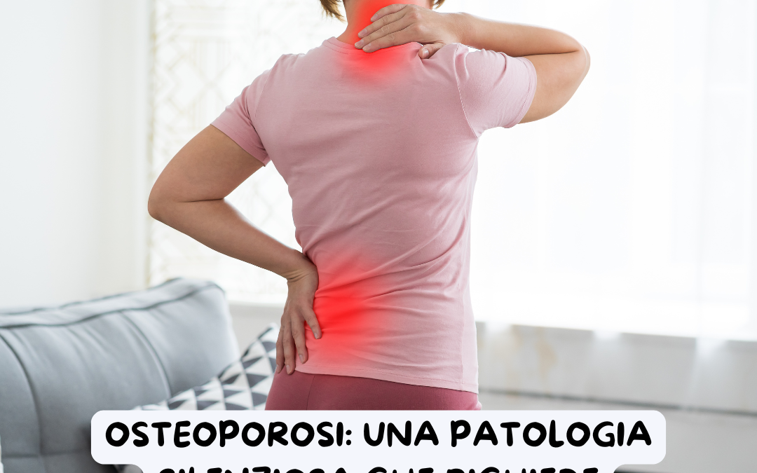 Osteoporosi: una patologia silenziosa che richiede attenzione specialistica